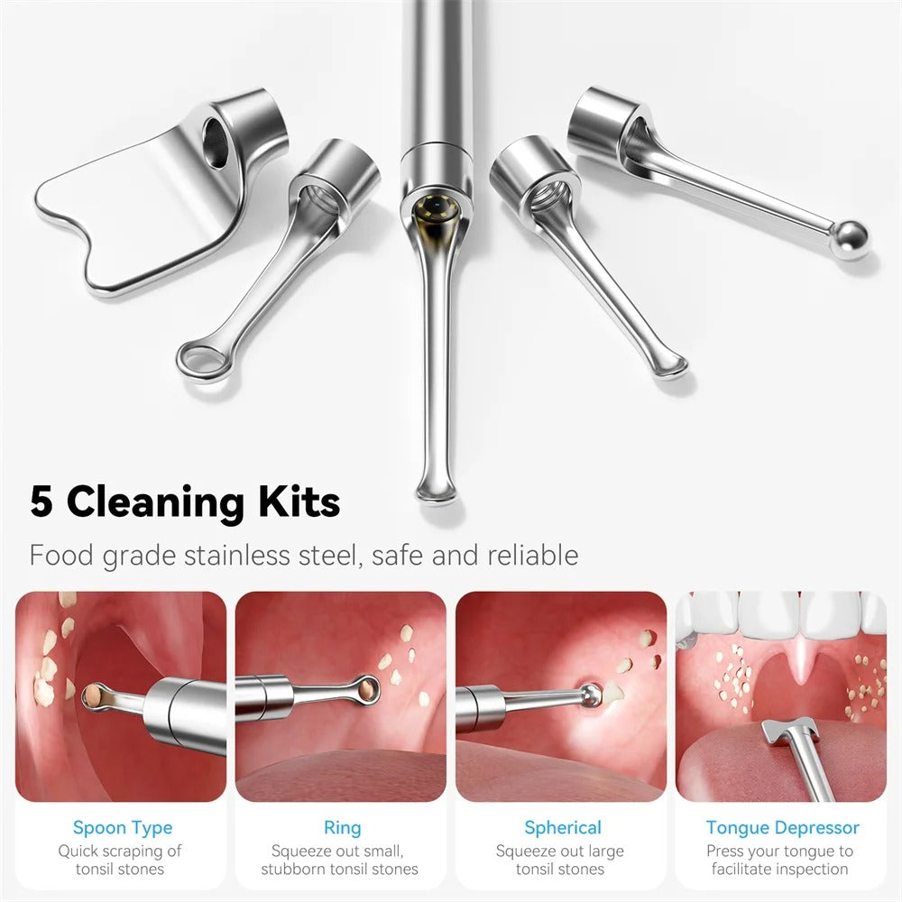 Visual Tonsil Stone Remover
